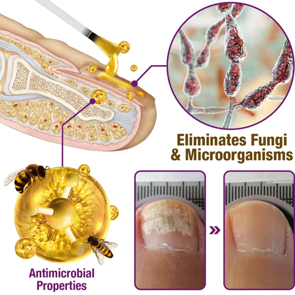 flysmus™ FungiFree Bienengift Nagelbehandlungsserum