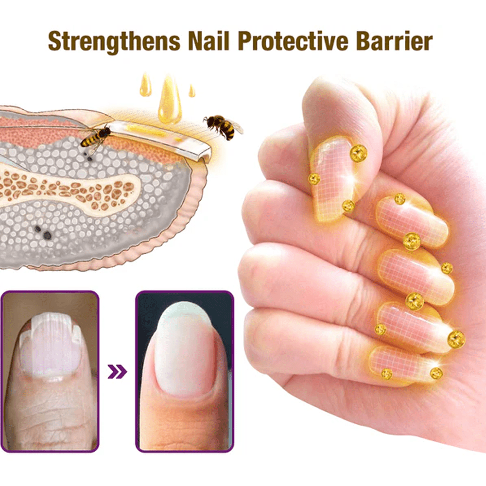 flysmus™ FungiFree Bienengift Nagelbehandlungsserum