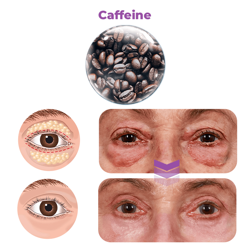 GFOUK™️ Milchflecken-Therapie Elektrischer Serum-Stif